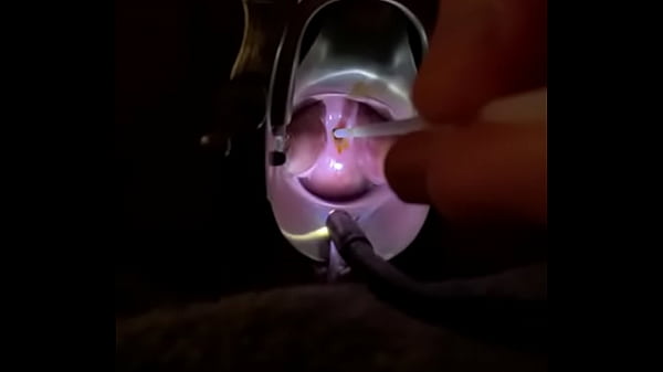 Fucking cervix w painful brush